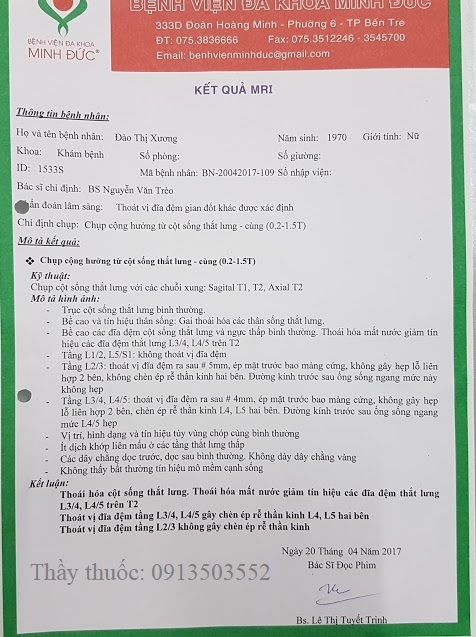 Chèn ép rễ thần kinh